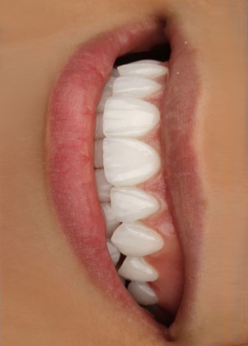 Dentistry Treatment Image